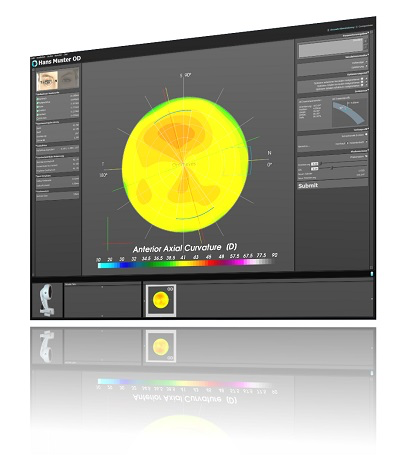 OptimEyes software -1 